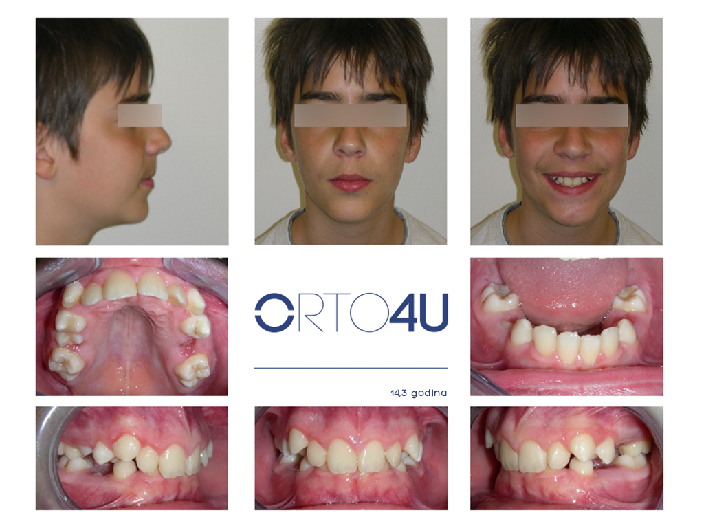 specijalisticka-stomatoloska-ordinacija-orto4u-galerija-osmeha10-1024x768