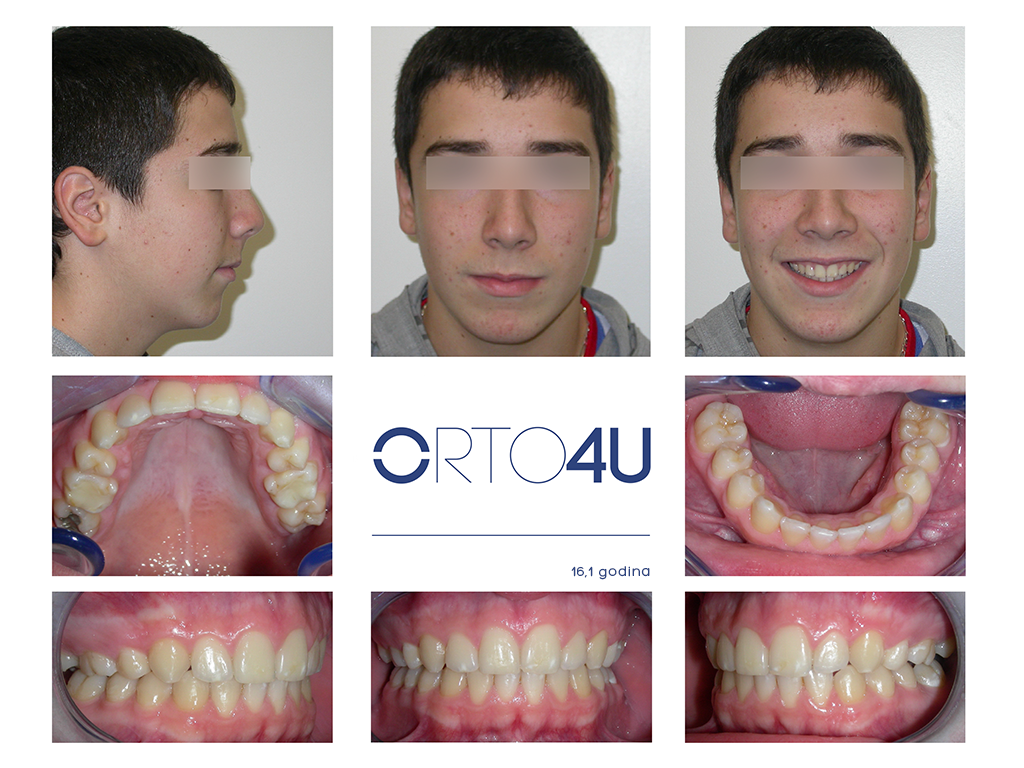 specijalisticka-stomatoloska-ordinacija-orto4u-galerija-osmeha5-1024x768