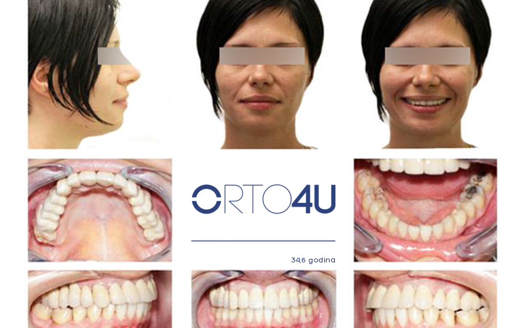 specijalisticka-stomatoloska-ordinacija-orto4u-galerija-osmeha7