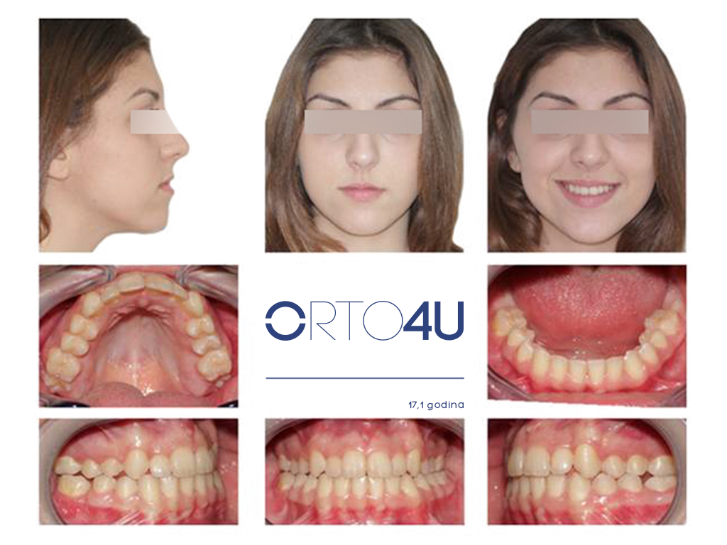 specijalisticka-stomatoloska-ordinacija-orto4u-galerija-osmeha9-1024x768